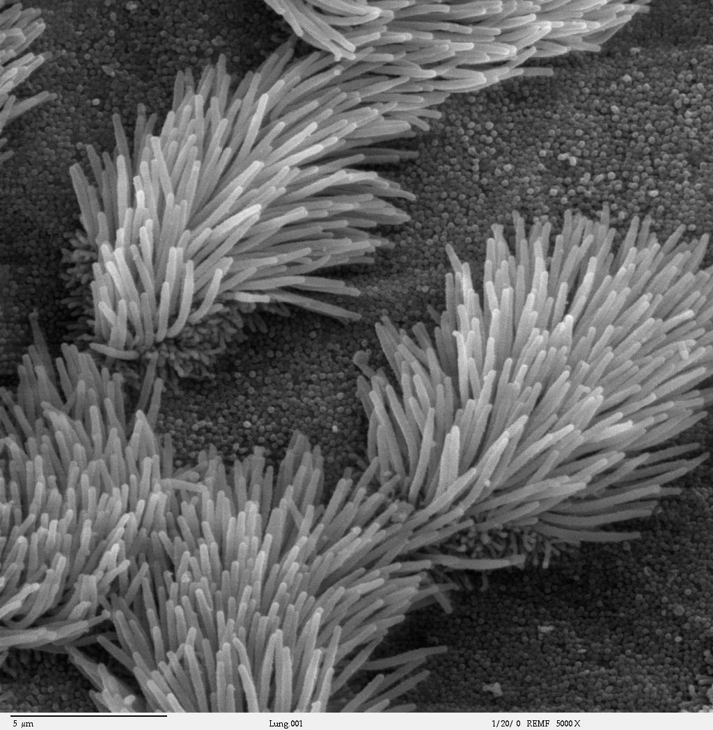 Zelula ziliatuak ikusten diren mikroskopio elektronikozko irudia.