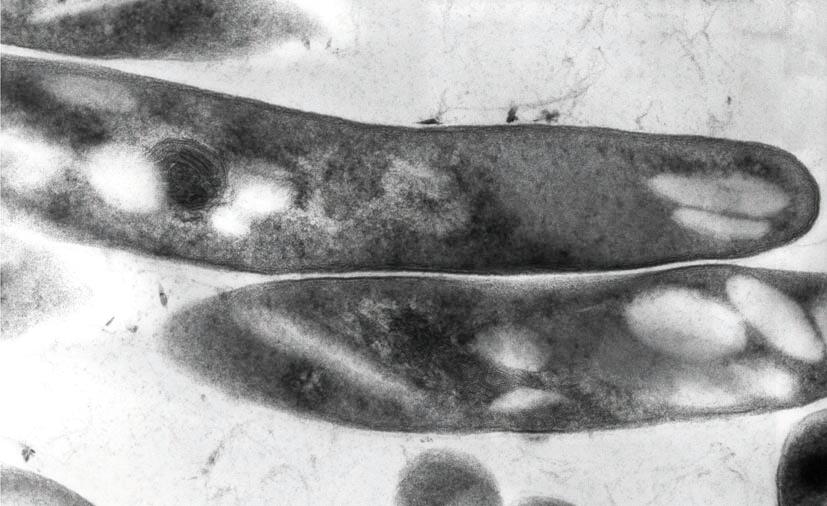 Mycobacterium tuberculosisen mikrografia